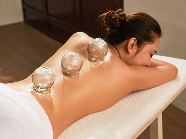 A female getting cupping therapist on the bed.